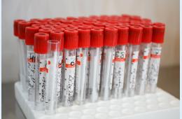 08.02.2022 Что приморцу нужно знать о штамме «омикрон» коронавируса. РАЗЪЯСНЕНИЯ, сообщает www.primorsky.ru | Администрация муниципального округа город Партизанск Приморского края Официальный сайт