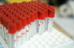 20.01.2022 Роспотребнадзор: «Омикрон» распространяется особенно интенсивно среди непривитых  | Администрация муниципального округа город Партизанск Приморского края Официальный сайт